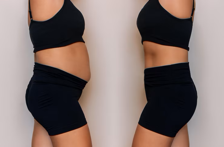 Antes e depois emagrecimento 1