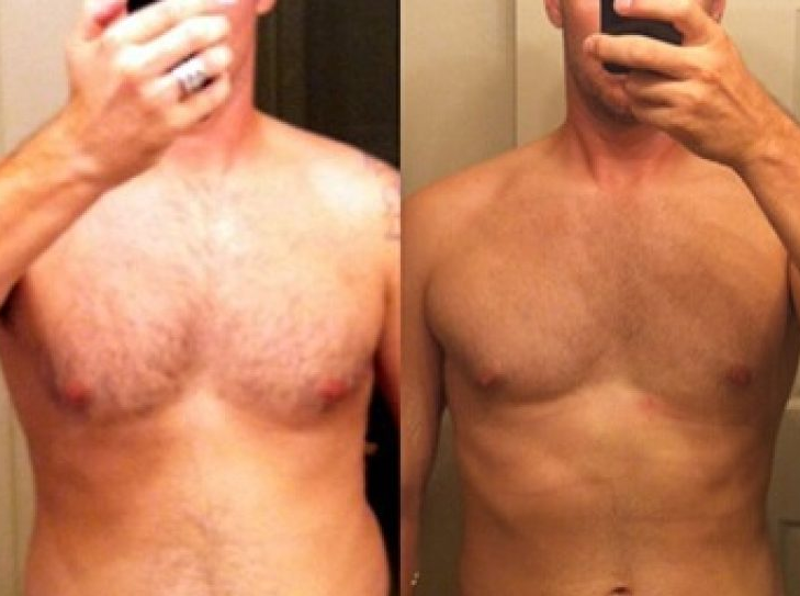 Antes e depois emagrecimento 3